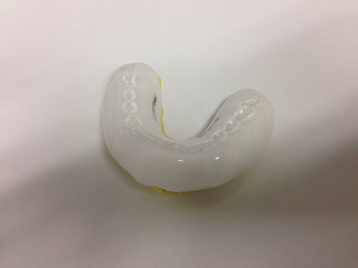 Mouthguard on model with opposing teeth indentations and name in within it