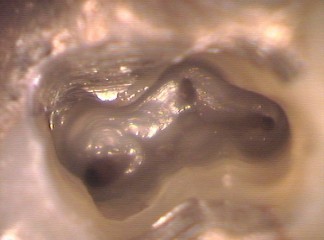 Root canal chamber showing black areas as root canal openings